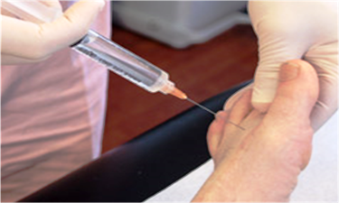 Prolotherapy (injection therapy)