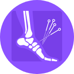 Dry needling -  Sydney Foot Clinic