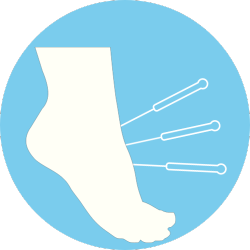 Dry needling -  Sydney Foot Clinic