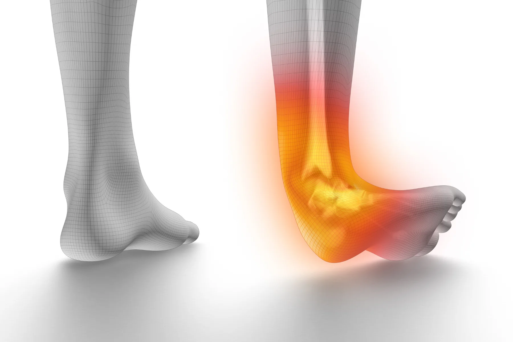 Ankle impingement