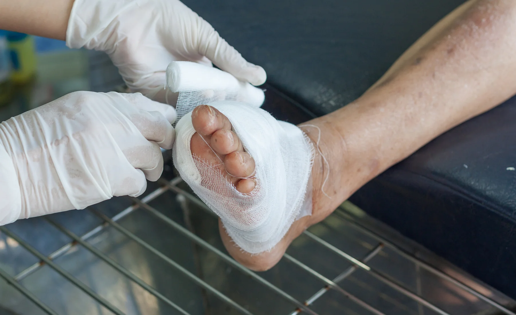 Diabetic Foot Care