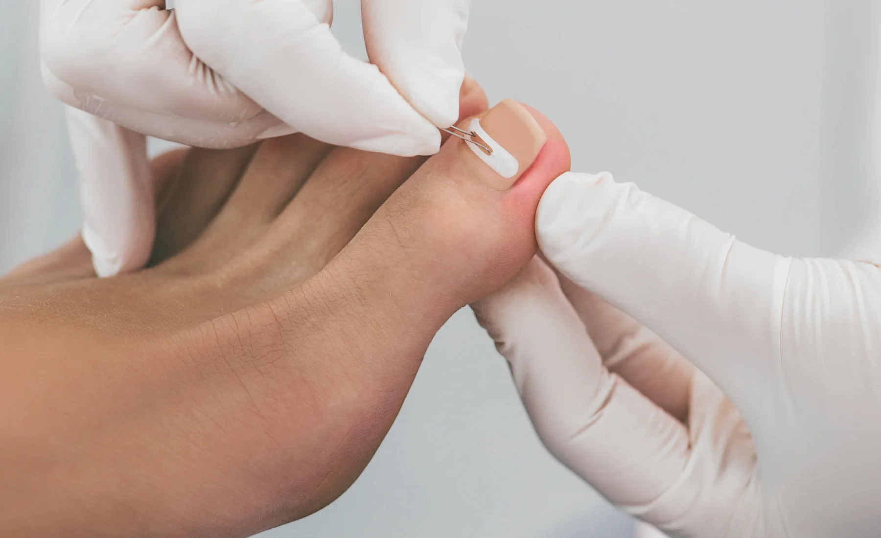Medical Pedicure 'MediPedi'