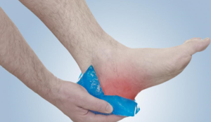 Heel Spur Syndrome
