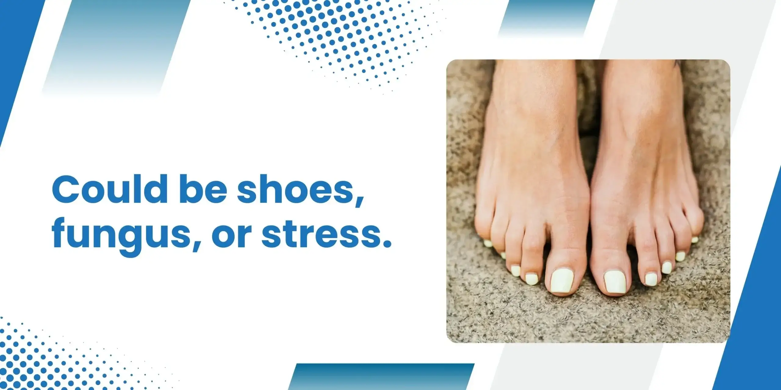 Home Remedies for Sore Toes